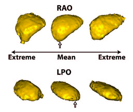 Afib2