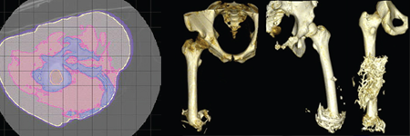 osseointegration