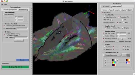 biotensor-vis-planes-fibers