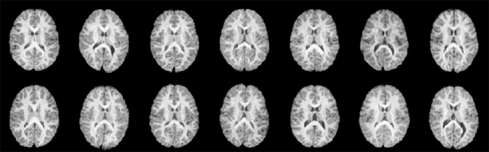 brainct slices