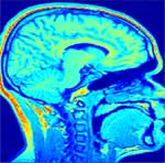 mri-epi figure-1