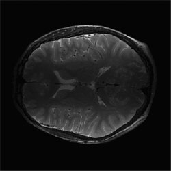 mri-epi figure-4