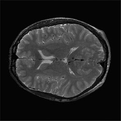 mri-epi figure-5